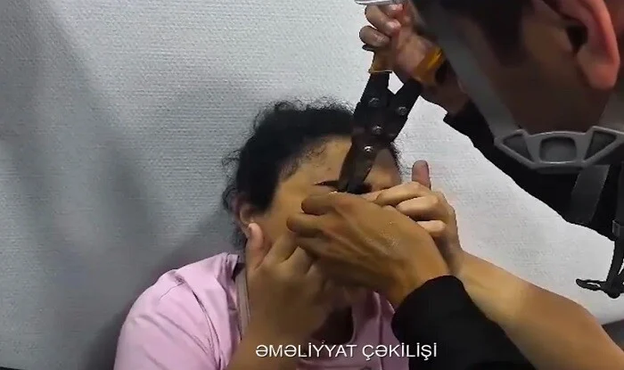 Göz qapağı zəncirbəndə ilişdi, FHN yardım etdi - <span class="text-danger">VİDEO</span>