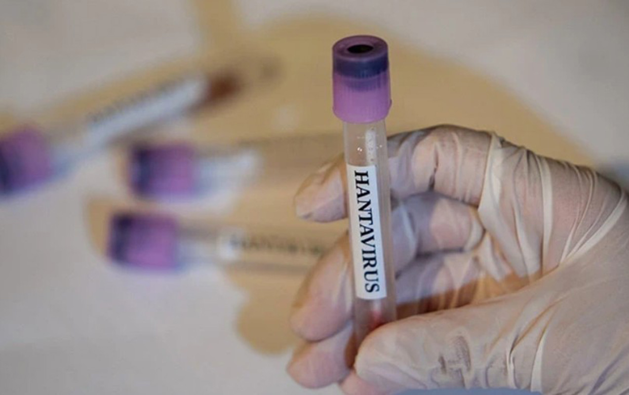 Ölümcül epidemiya bu tarixdə başa çatacaq