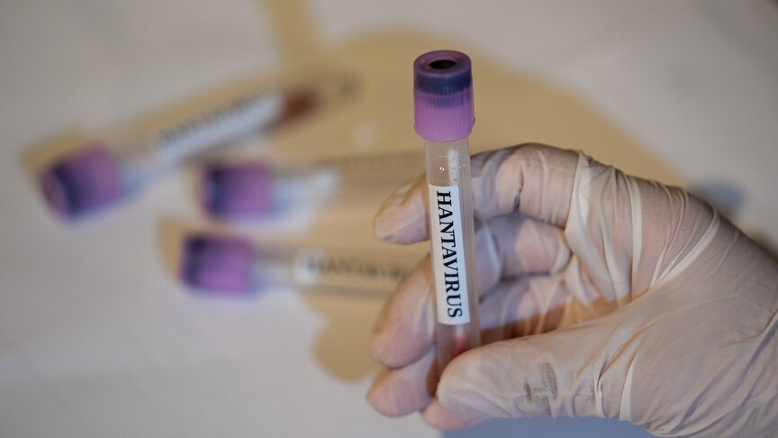 Australia’s most populous state detects suspected case of deadly H5N1 bird flu