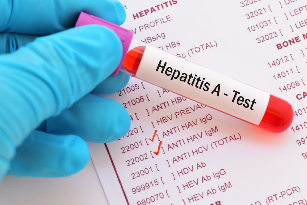 Valideynlərin NƏZƏRİNƏ: Hepatit A virusu yayılıb