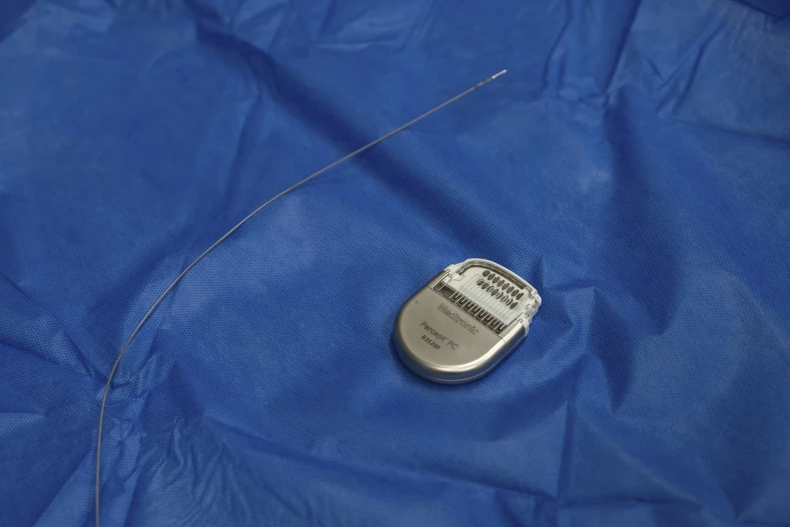 A pacemaker for the brain helped a woman with crippling depression