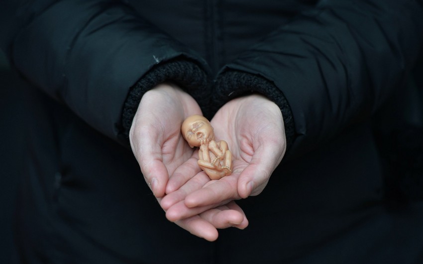 Qanunsuz aborta görə cəzaların sərtləşdiriləcək