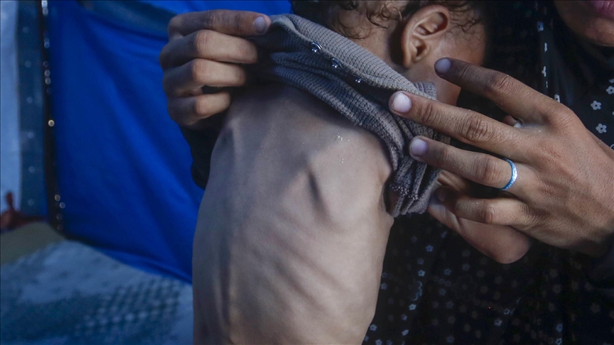Without immediate intervention, malnutrition crisis in Gaza to deteriorate further, WHO warns